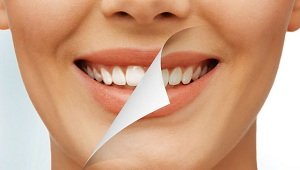 Отбеливание зубов - эффективные способы